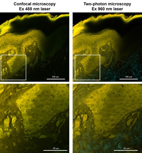 FNA-HistoBright-human-dermal tissue-CLSM-TPEF-S.jpg